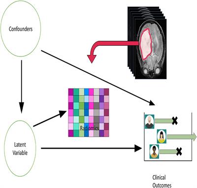 Causal Inference in Radiomics: Framework, Mechanisms, and Algorithms